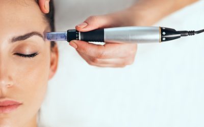 Microneedling vs. Chemical Peels: Which Treatment Is Right for You?