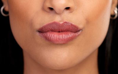 Radiesse® vs. Hyper-Diluted Radiesse®: Which Treatment Fits Your Goals?
